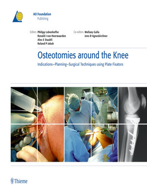 cover image of Osteotomies Around the Knee